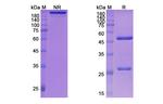 Zelminemab Humanized Recombinant Human Monoclonal Antibody