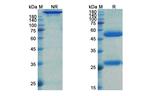 IL-6 Receptor (CD126) (Tocilizumab Biosimilar) Antibody in SDS-PAGE (SDS-PAGE)