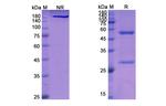 CD20 (Veltuzumab Biosimilar) Antibody in SDS-PAGE (SDS-PAGE)