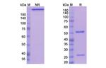 Teplizumab Humanized Recombinant Human Monoclonal Antibody