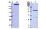 Trastuzumab Humanized Antibody in SDS-PAGE (SDS-PAGE)