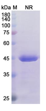 Certolizumab Antibody in SDS-PAGE (SDS-PAGE)
