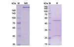 Brentuximab Humanized Recombinant Human Monoclonal Antibody