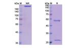 Human IgE (Talizumab Biosimilar) Recombinant Human Monoclonal Antibody