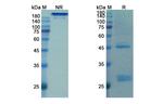 Bamlanivimab Humanized Antibody in SDS-PAGE (SDS-PAGE)