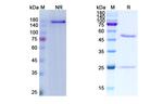 SARS-CoV-2 Spike Protein RBD (Cilgavimab Biosimilar) Antibody in SDS-PAGE (SDS-PAGE)