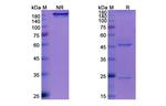 Sotrovimab Humanized Antibody in SDS-PAGE (SDS-PAGE)