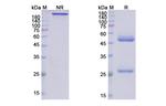SARS-CoV-2 Spike Protein RBD (Etesevimab Biosimilar) Antibody in SDS-PAGE (SDS-PAGE)