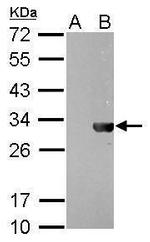 HSV Tag Antibody in Western Blot (WB)