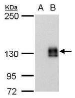 mCherry Monoclonal Antibody (GT235)