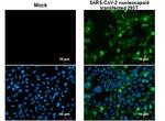 SARS/SARS-CoV-2 Nucleocapsid Monoclonal Antibody (GT113)