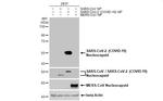 SARS/SARS-CoV-2 Nucleocapsid Antibody in Western Blot (WB)