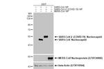 SARS/SARS-CoV-2 Nucleocapsid Antibody in Western Blot (WB)