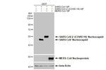 SARS/SARS-CoV-2 Nucleocapsid Antibody in Western Blot (WB)