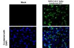 SARS/SARS-CoV-2 Spike Protein S2 Monoclonal Antibody (GT8110)