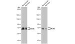 Acetylcholinesterase Antibody in Western Blot (WB)