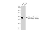 Androgen Receptor (ARv7 Splice Variant) Recombinant Rabbit Monoclonal Antibody (HL1028)
