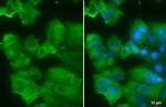 AGR2 Recombinant Rabbit Monoclonal Antibody (HL1024)
