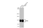 DDR2 Recombinant Rabbit Monoclonal Antibody (HL1107)