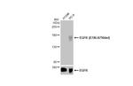 EGFR (E746-A750del) Recombinant Rabbit Monoclonal Antibody (HL363)