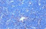 Phospho-GRK2 (Ser670) Recombinant Rabbit Monoclonal Antibody (HL1035)