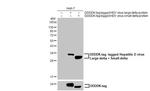 Hepatitis D virus Recombinant Rabbit Monoclonal Antibody (HL1053)