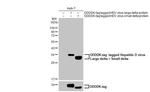 Hepatitis D virus Recombinant Rabbit Monoclonal Antibody (HL1055)