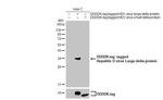 Hepatitis D Virus Large delta Protein Antibody in Western Blot (WB)