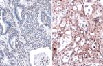 K-Ras (G12V Mutant) Antibody in Immunohistochemistry (Paraffin) (IHC (P))