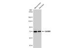 SARM Antibody in Western Blot (WB)