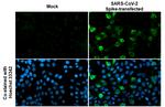 SARS-CoV-2 Spike Protein S2 Recombinant Rabbit Monoclonal Antibody (HL1039)