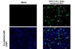 SARS-CoV-2 Spike Protein S2 Antibody in Immunohistochemistry (Paraffin) (IHC (P))