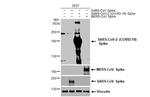 SARS-CoV-2 Spike Protein S2 Antibody in Western Blot (WB)