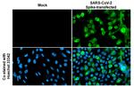 SARS/SARS-CoV-2 Spike Protein S2 Antibody in Immunocytochemistry (ICC/IF)
