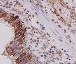Cytokeratin 7 Monoclonal Antibody (3-G3-D8)