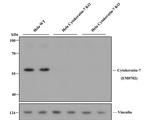 Cytokeratin 7 Antibody in Western Blot (WB)