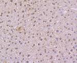NFIB Antibody in Immunohistochemistry (Paraffin) (IHC (P))