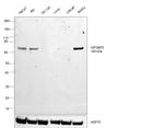 IGF2BP3 Antibody in Western Blot (WB)