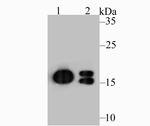 NME1 Monoclonal Antibody (13C2)