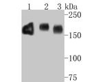 EGFR Antibody in Western Blot (WB)