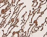 CEACAM6 Antibody in Immunohistochemistry (Paraffin) (IHC (P))