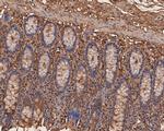 CEACAM6 Antibody in Immunohistochemistry (Paraffin) (IHC (P))