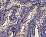 CEACAM6 Antibody in Immunohistochemistry (Paraffin) (IHC (P))