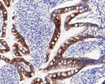 Cytokeratin 20 Monoclonal Antibody (A3H7)
