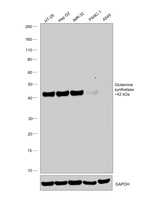 Glutamine Synthetase Antibody in Western Blot (WB)