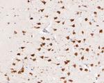 CUG-BP2 Antibody in Immunohistochemistry (Paraffin) (IHC (P))