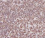 Ku70 Antibody in Immunohistochemistry (Paraffin) (IHC (P))