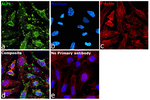 ALPL Recombinant Rabbit Monoclonal Antibody (SA40-00)