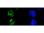 Cyclin D1 Recombinant Rabbit Monoclonal Antibody (SA38-08)