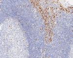 Cyclin D1 Antibody in Immunohistochemistry (Paraffin) (IHC (P))